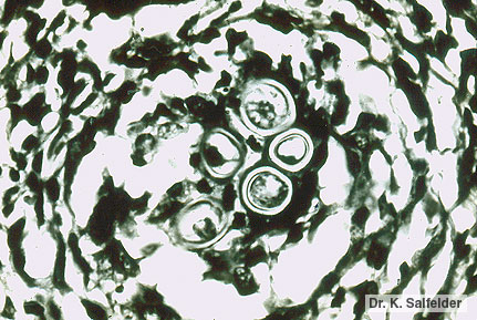 Abb. 1,11