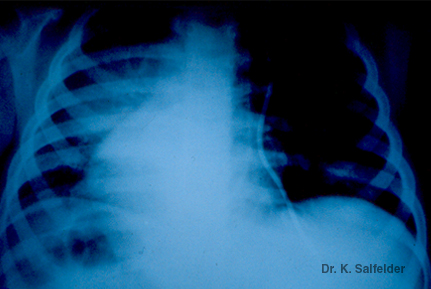 Abb. 20E,6