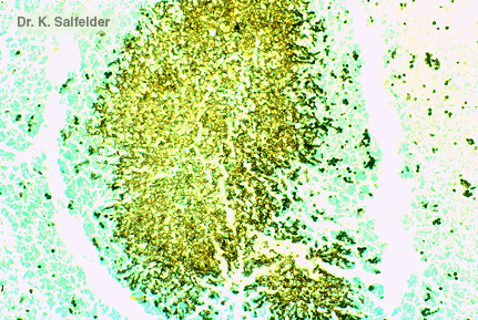 Abb. 21D,2