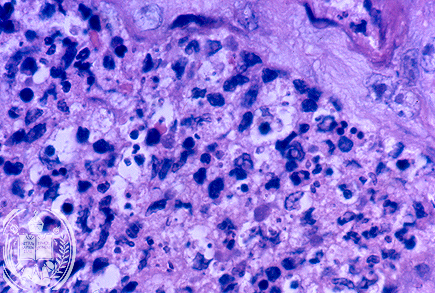 Fig. 11-A3