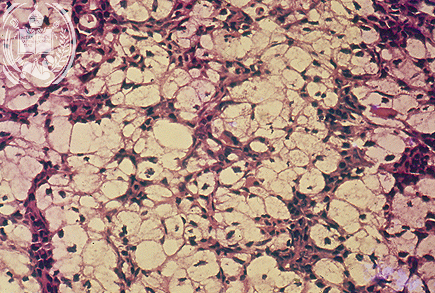 Fig. 58-A2