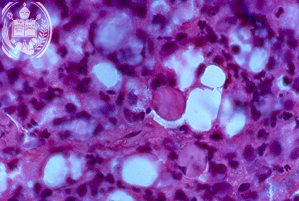 Fig. 58-A5