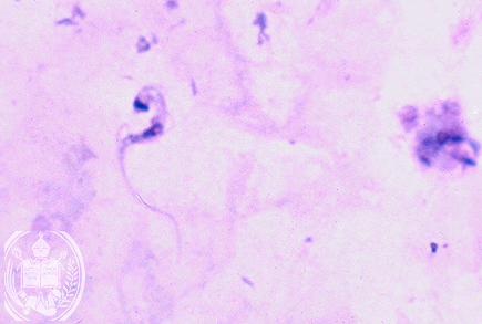 Fig. 60-A2