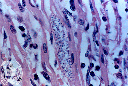 Fig. 60-A4