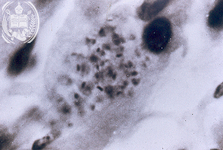 Fig. 60-A5