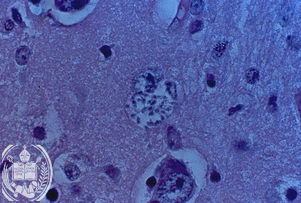 Fig. 60-A6