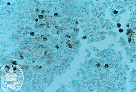 Fig. 64-A5