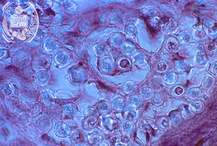 Fig. 66-A2