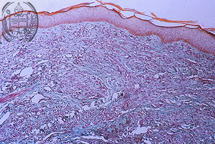 Fig. 68-A2