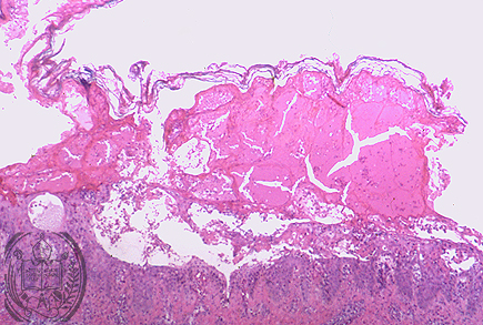Fig. 68-B2