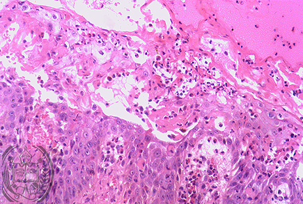 Fig. 68-B3