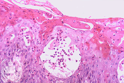 Fig. 68-B4