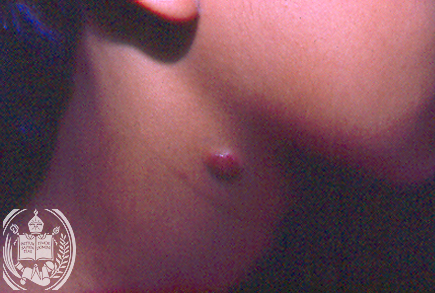 Fig. 12-B1