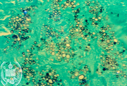 Fig. 13-A4