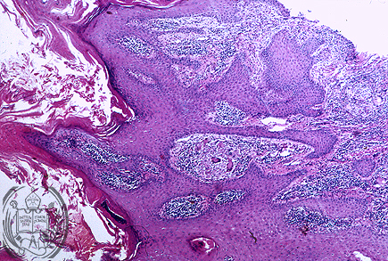 Fig. 43-A2