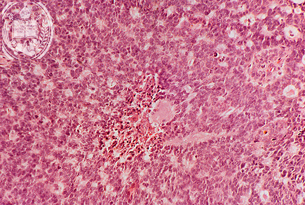 Fig. 46-B2