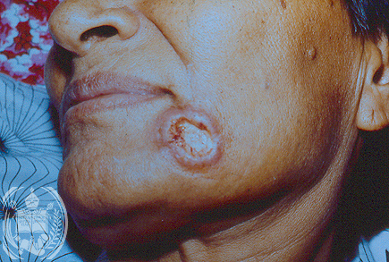 Fig. 48-A1