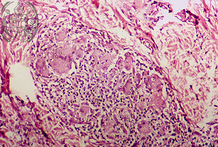 Fig. 49-A2