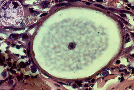 Fig. 51-A4