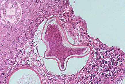 Fig. 53-A4