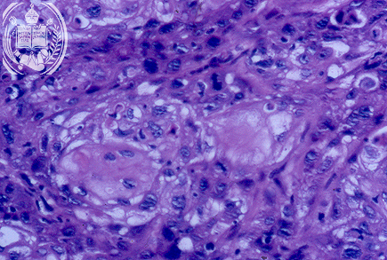Fig. 56-B2